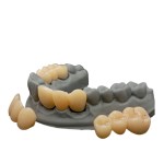 D-Tech 3D Accuprint Crown & Bridge Pro 3D Printing Resin
