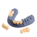 D-Tech 3D Accuprint Crown & Bridge Pro 3D Printing Resin
