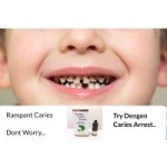 Dengen Caries Arrest SDF 38% 5ml