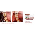 Dental Dengen Dengocem 2 Glass Ionomer Cement