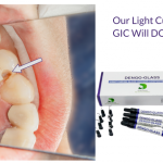 Dengen Dengoglass Light Cure Gic 4*2gm