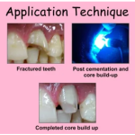 Prevest Fusion Core DC Flo 9gm Pack