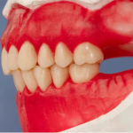 Prevest Hiflex Modelling Wax