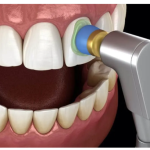Spectra Finishing & Polishing Paste