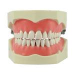 DENTAL STUDY MODEL
