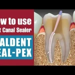 Waldent Seal-Pex