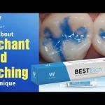 Waldent BESTEtch Economy Pack (Pack of 4)