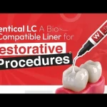 Waldent Dentical LC Calcium Hydroxide Liner