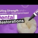 Waldent Glasseal Glass Ionomer Liner LC