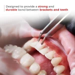 Waldent Orthobond Light Cure Orthodontic Adhesive Kit