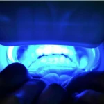 Woodpecker LED D Cure Light Unit