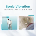 SuperEndo Sonic Flush Endo Irrigator (60 Tips Free)