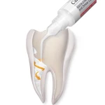 Septodont Canal + EDTA Gel 17%