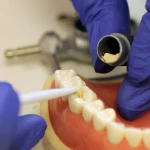 Septodont Biodentine Kit