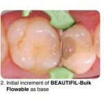 Shofu Beautifil Bulk Flowable Composite