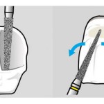 Shofu Direct Cosmetic Restoration Kit