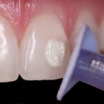 Shofu Direct Dia Diamond Polishing Paste